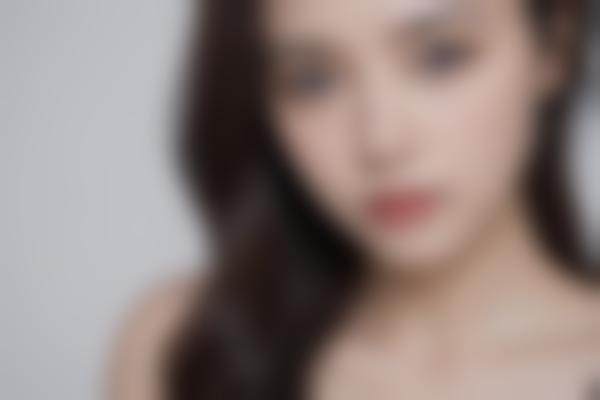 为什么选潘彦龙做双眼皮修复？