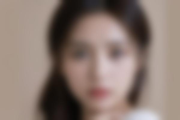 曹阳医生眼修复技术有哪些独特优势？