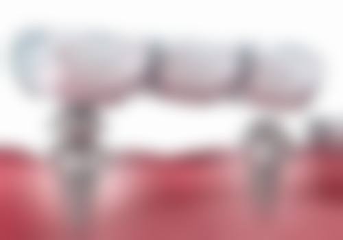 5、广东省人民医院口腔科——综合医院口腔科，颌面外科强