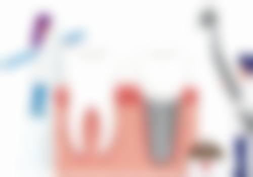 2、广州曙光口腔医院——私立连锁，服务与技术双优