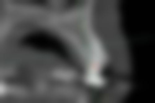 1、深圳哪里看牙齿好的医院:北京大学深圳医院口腔科（深圳哪个医院看牙齿更好）