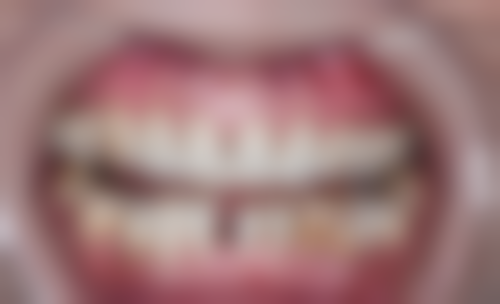 三、深圳哪里看牙齿好的预约挂号攻略