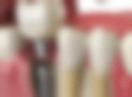 3、深圳哪里看牙科好:同步齿科（深圳哪里看牙齿比较好）