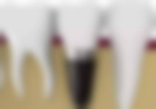 奥齿泰技术成熟，复杂病例选它准没错