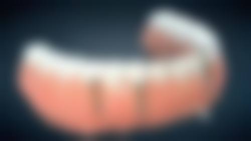 韩国八维价格低，简单病例预算有限选它