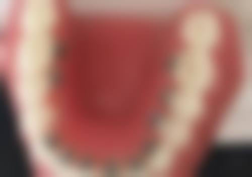 六、聊城市东昌府区妇幼保健院口腔科特色技术及诊疗优势