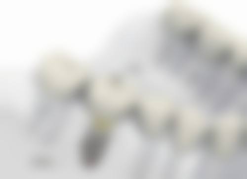 西安德雅口腔门诊部（莱安中 心店）特色项目