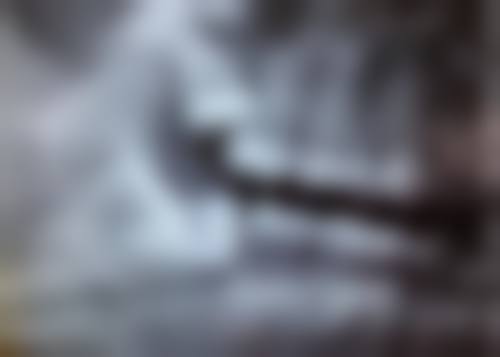 根管治疗消除牙周炎感染源的方法