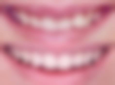 陕西贝齿乐口腔医院口碑好不好？患者诊室评价：