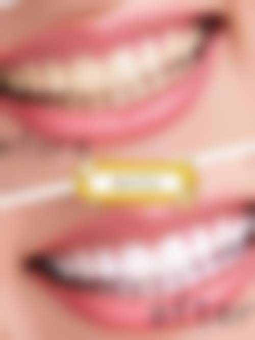 山西临汾侯马雅美口腔连锁医院正规可靠吗？