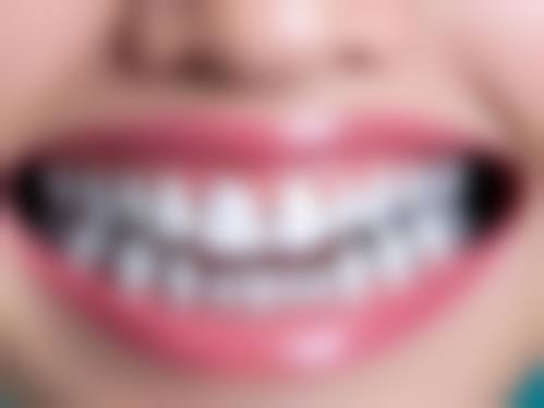 三、广东深圳余昌武口腔技术与优势