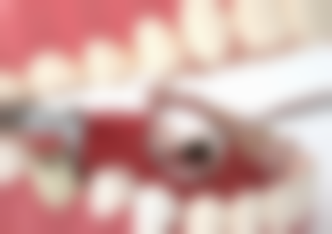 询问与预约前,必须确认的关键问题清单