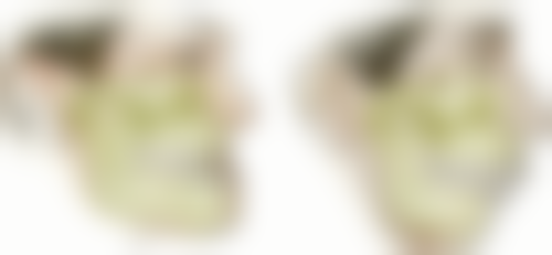 哪些情况通常不被认为是合适指征？