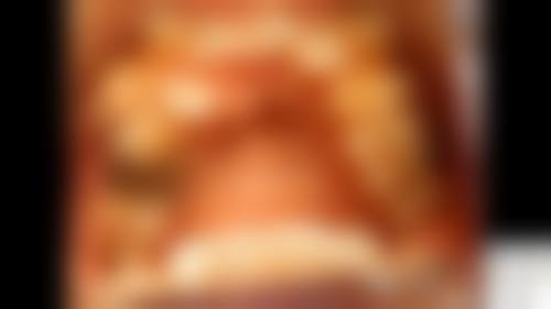 不同矫正方案的差异点