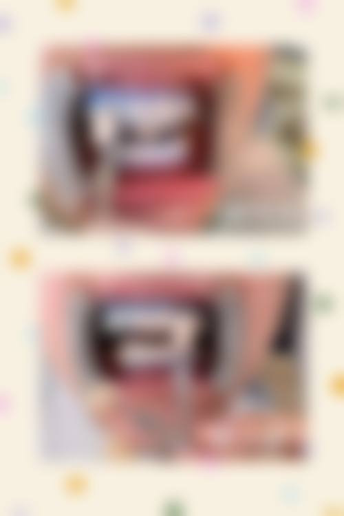 常见的烤瓷牙美白方式大盘点