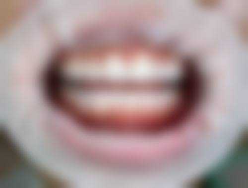 北流班兆义口腔诊所开展项目及特色技术