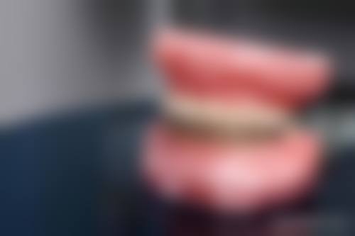 如何为18岁牙齿矫正设定一个合理且可验证的成效目标