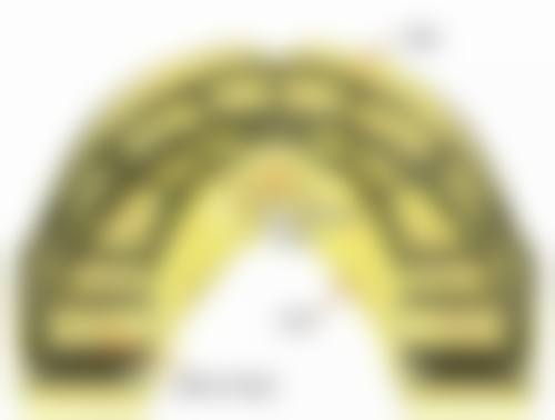 骨性凸嘴拔牙矫正改善面型是什么？在什么情况下会被选择？