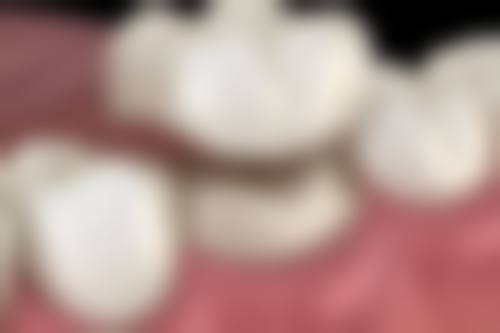 一、韩国毛莱茵植发是正规医院吗?