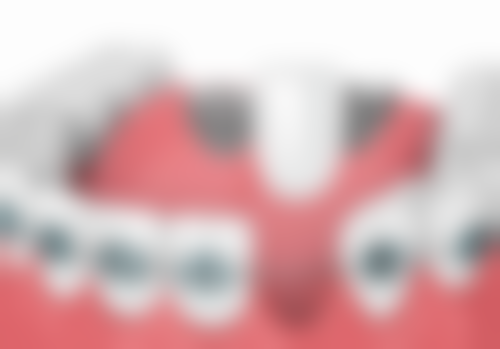 七、锦州田宇口腔门诊部患者常见问题