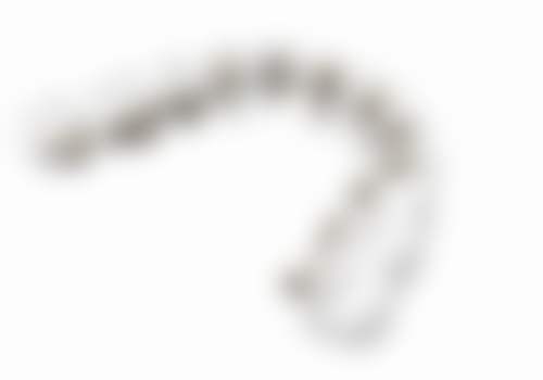 八、种植牙与烤瓷牙的成效稳定性取决于哪些因素？