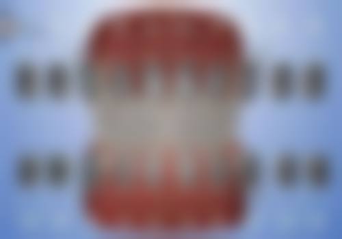 怎么判断三岁儿童是否适合洗牙?综合评估特别关键