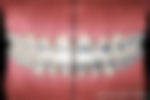 五、南通民博口腔种植牙怎么样