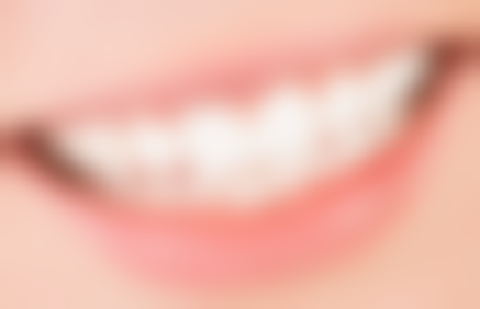 牙齿矫正费用8000元起的构成