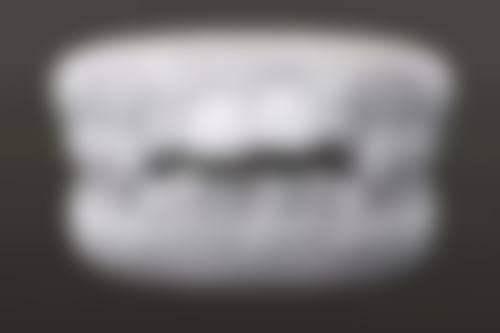 山西医 科 大学第一医院口腔正畸科收费价目表公开：收费能用医疗保险报销吗？价格到底贵不贵?