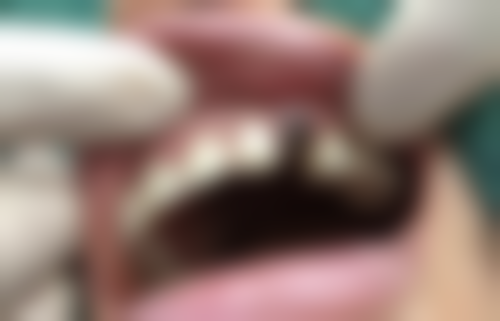 深圳初心弘瑞口腔诊所技术与优势