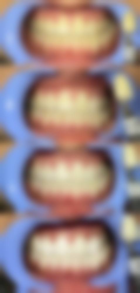 模状缺损补牙视频真的能了解全过程吗？能！清晰展示步骤，实用科普让你秒懂补牙！ 