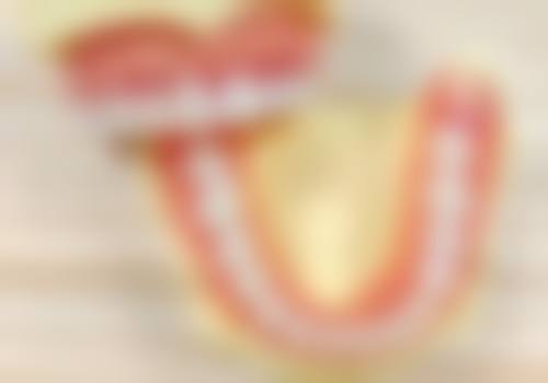 装假牙成效预期的真实边界