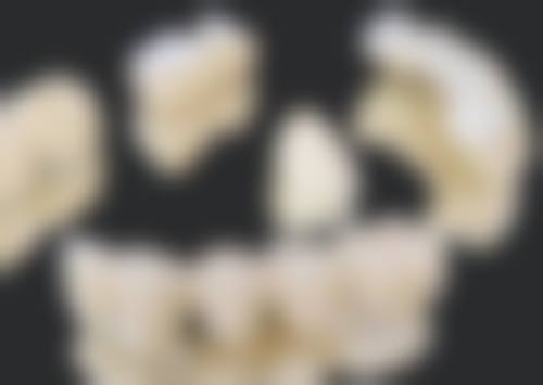 儿童6岁牙齿蛀了需要补牙吗？当然需要！防疼痛、保恒牙、助咀嚼，好处一个不落！ 