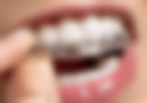 哪些人群在评估中更可能被建议考虑矫正牙齿拔牙？