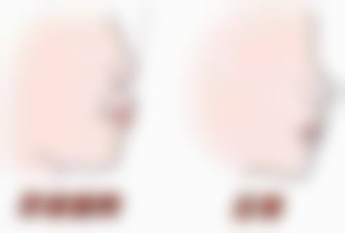 拔牙三年后种植牙齿是怎么出现的（来源与背景）