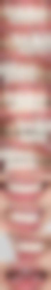 28岁牙齿矫正成效不理想的补救与修复空间