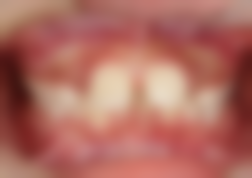 香港良心牙醫推薦：適合邊類人群？