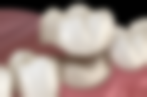 香港 深圳格倫菲爾牙科好唔好：揀分店+醫生避坑指南