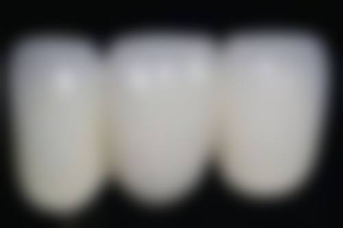 香港 深圳穗華口腔2026價格表 適合邊類人群？呢幾類人去更抵！