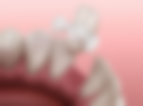 香港 深圳格倫菲爾牙科好唔好：技術過唔過關？種牙/矯正有咩特色？