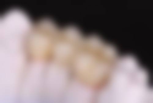 拓展延伸：港人北上睇牙必知3件事