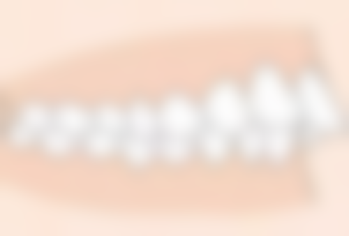 香港 深圳穗華口腔2026價格表 項目大公開：種牙/矯正/補牙邊樣更抵？