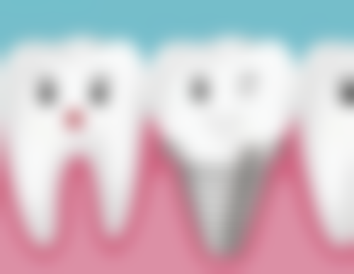 上海全口种植牙齿不同医院的价格差异