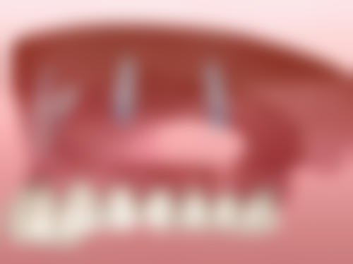 香港 深圳睇牙lihkg 适合边类人群?三类姊妹必睇