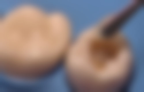 二、揭秘:隐形牙套20000元起,这个价格在广州市一医院是什么水平?