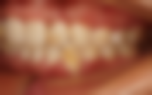 香港 深圳格倫菲爾牙科好唔好：真實口碑點樣？港人體驗分享