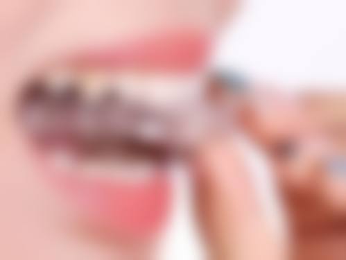 广州中南口腔种牙价格明细