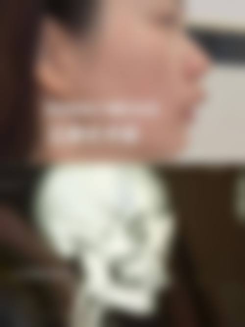 武汉华美整形医院