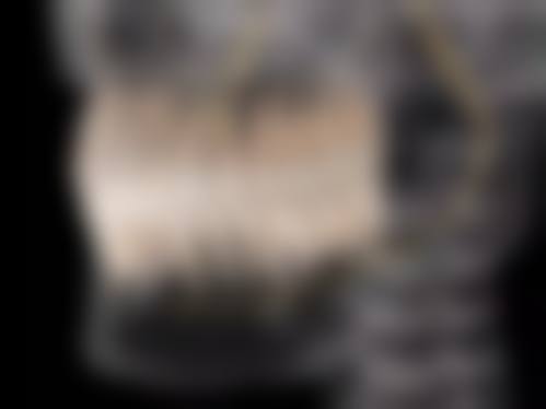 六、医院到底有多大牌?郑州大学第一附属医院的实力与排名解读