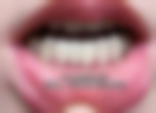 广州市第一人民医院口腔科在线咨询：牙齿矫正隐形牙套20000元起，种植牙5000元起，2026年看牙价格清单大公开！